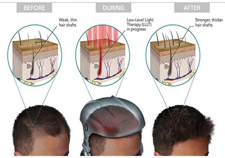 Image-HasTech